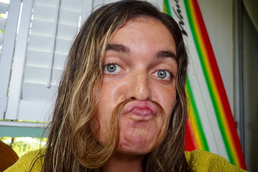 📵 Letter 86: Phoneless 48 hours, Biking 42 Miles, Lanai